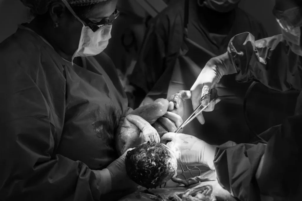 Svartvitt foto visar scener från operation, där ljuset faller på det nyfödda barnet